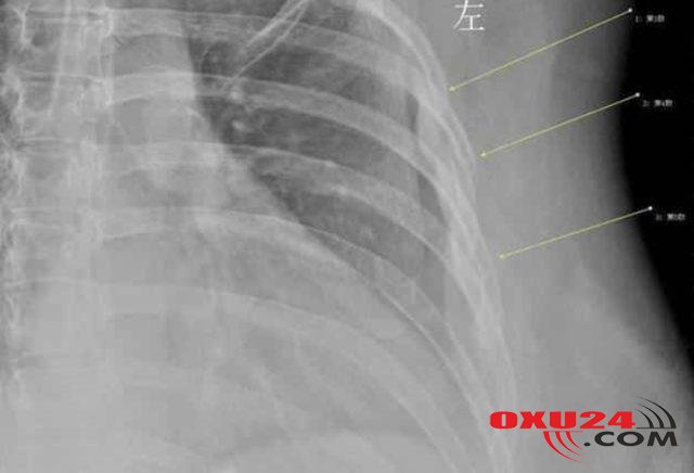 Gündə 10 stəkan içdi, başına bu hadisə gəldi - İDDİA