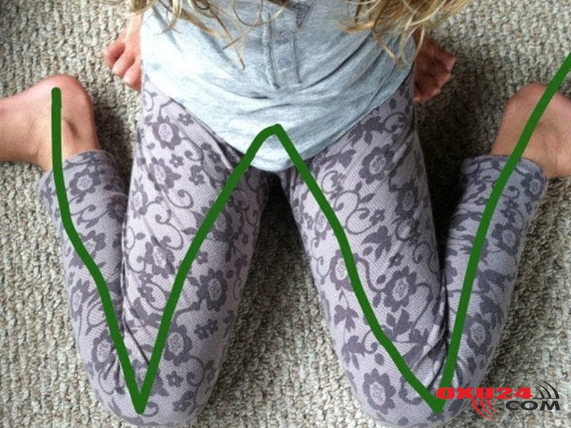 “W” şəklində oturmaq nədir?