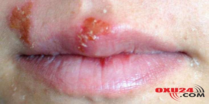 Diyetoloqlar dünyanın ən faydalı 10 məhsulunu təyin ediblər