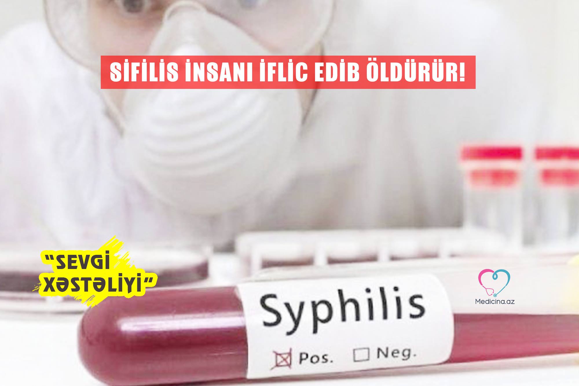 “Sevgi xəstəliyi” - Sifilis insanı iflic edib öldürür!