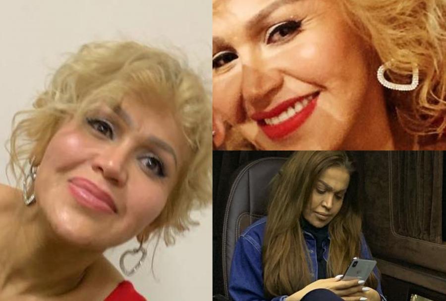 Rəqsanə niyə bu hala qalıb? - Fotolar