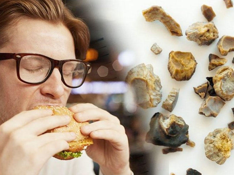 Bu qidalar böyrək daşı yaradır - SİYAHI