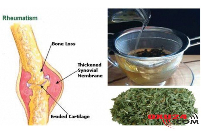 Bu xalq təbabəti vasitəsilə revmatizma birdəfəlik yoxa çıxacaq!