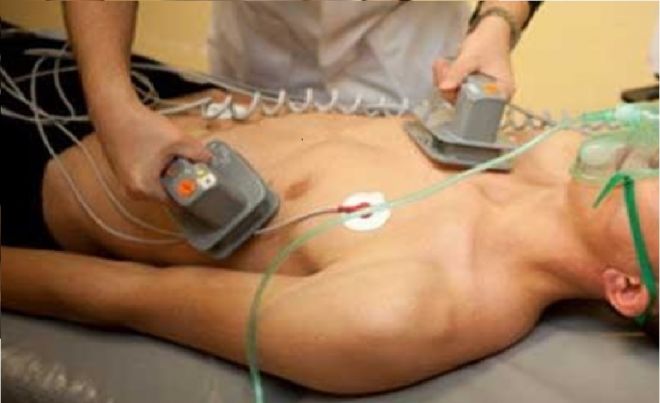 Ölən adama 5 min volt ELEKTRİK verdilər - Nəticə hamını ŞOKA SALDI