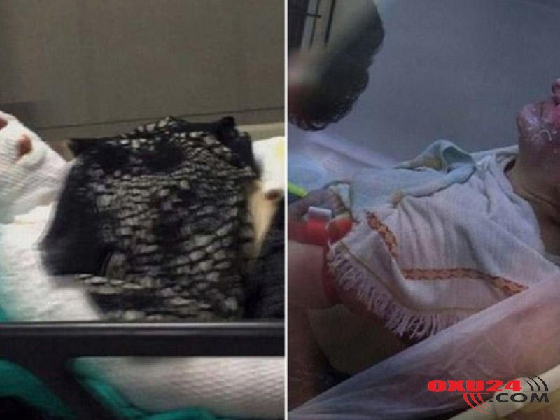 Ərinin qulaq tüklərini təmizləmək istədi - İKİSİ DƏ YANDI - FOTO