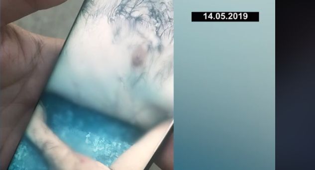 Bakıda 80 bıçaqla öldürülən kriminal avtoritetin meyitinin  DƏHŞƏTLİ  GÖRÜNTÜSÜ