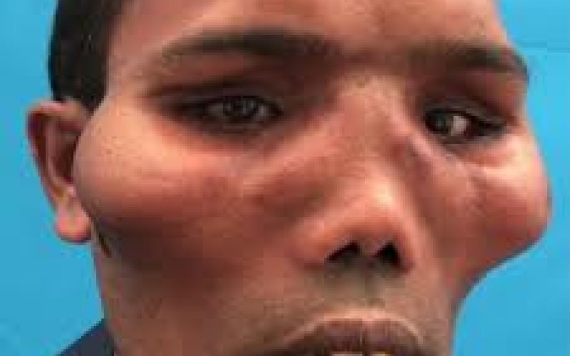 Aslan sifət oğlan dəyişib bu hala düşdü, heç kim tanımadı