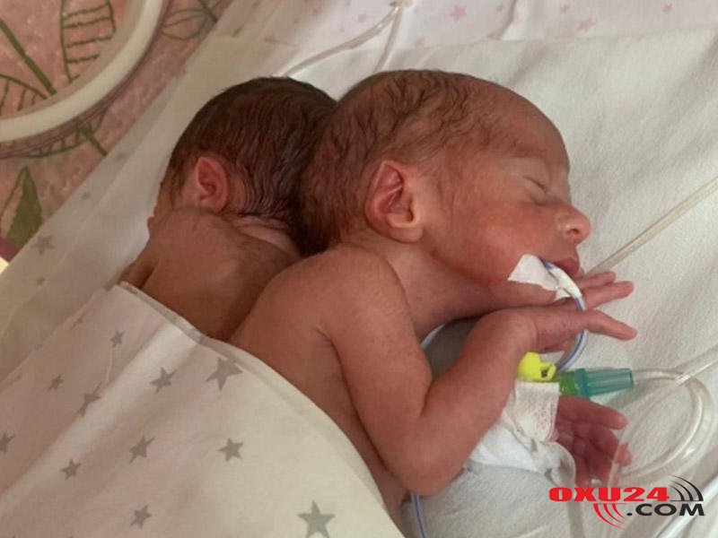 Bakıda dördəm dünyaya gəlib - FOTO