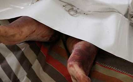 Bakıda DƏHŞƏT: Ər xəyanətə görə arvadının başını kəsib, 4-cü mərtəbədən atdı