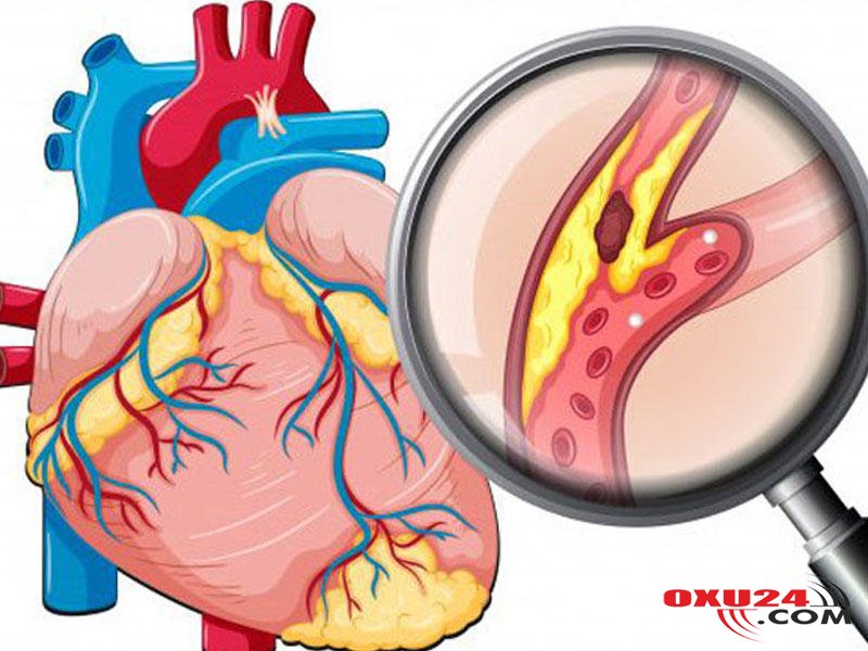 Damar tıxanmasından bizi qoruya biləcək 7 məhsul 