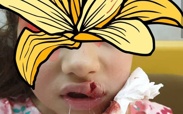 Bakıda dəhşətli hadisə:It insanların gözü qarşısında uşağın üzünü parçaladı