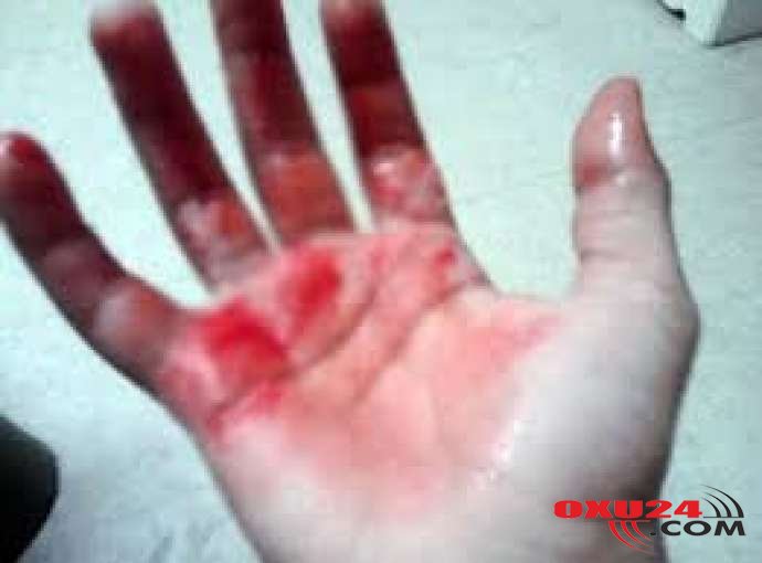 Sumqayıtda salam verməmək üstündə çayxananın arxasında qan töküldü — TƏFƏRRÜAT