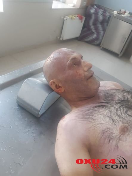 Bu meyiti tanıyanlar polisə xəbər etsin - FOTO