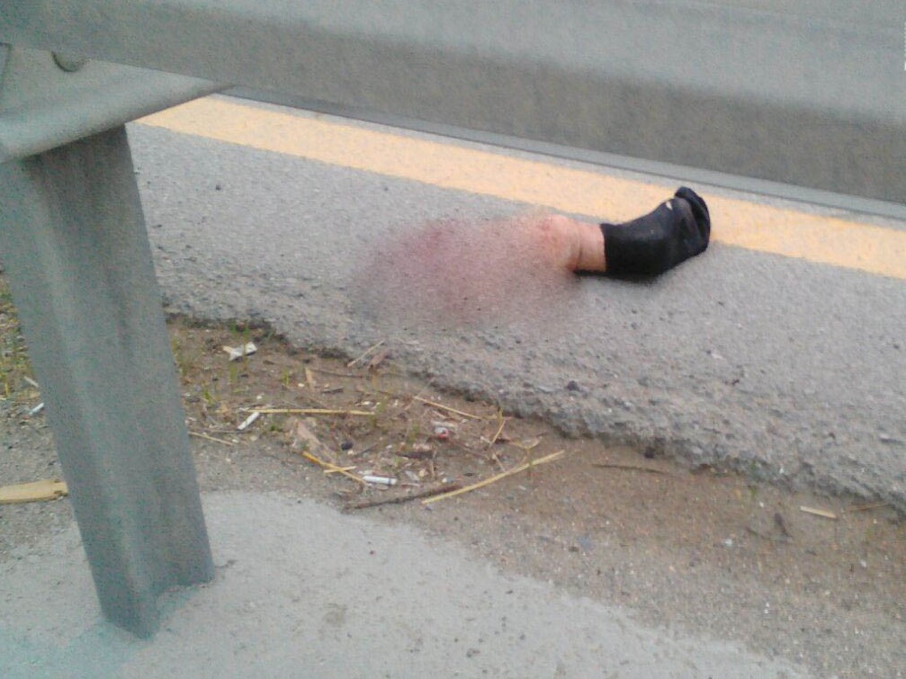 Bakıda maşın vuran piyadanın ayağı qopdu - şok görüntülər