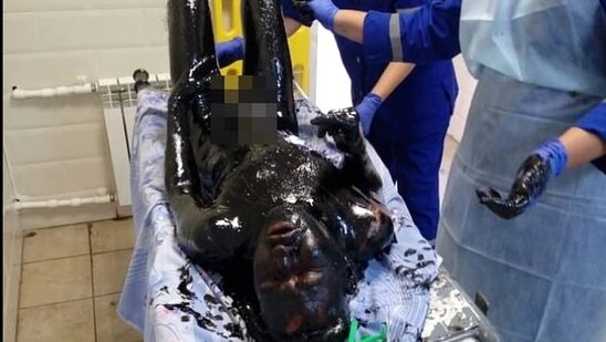 Qorxunc mənzərə: Qır gölməçəsindən insan bu halda tapıldı