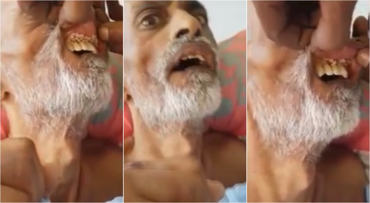 ŞOK görüntü: Dəhşətli xəstəlik yayılıb, qurdlar insanı belə yeyir