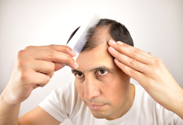 KiŞİLƏR DİQQƏT: keçəlləşmənin qarşısını alan qidaların SİYAHISI