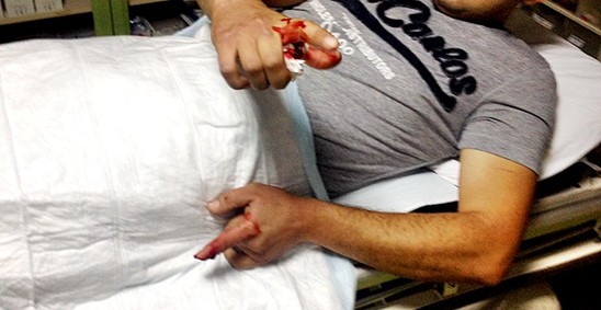 Azərbaycanda dəhşətli hadisə: Kişinin gözü çıxdı,barmaqları qopub düşdü