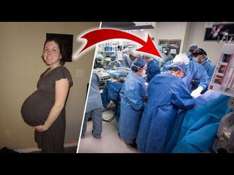 Əkiz Uşaq Gözləyirdi - Doğuşa Girəndə Həyatının Şokunu Yaşadı