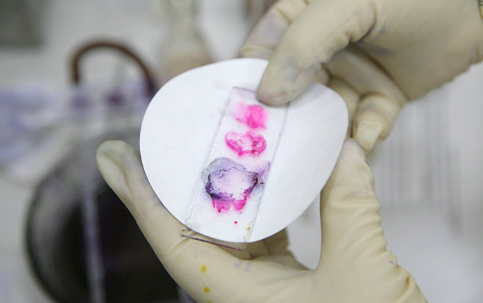 SON DƏQİQƏ! Ermənistanda öldürücü təhlükəli xəstəlik yayıldı