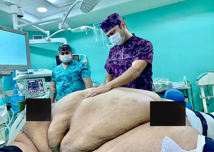 Bakıda 256 kiloqramlıq qadının üzərində inanılmaz əməliyyat olunub – Foto