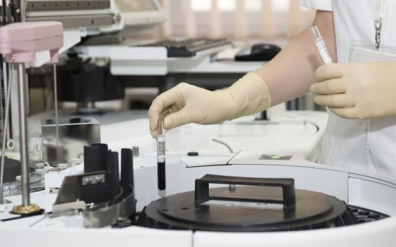 Rusiyaya gələn dəhşətli təhlükə Azərbaycana keçə bilərmi?