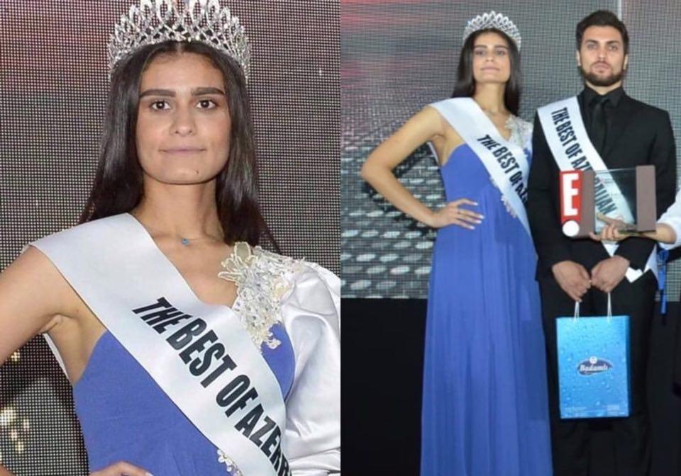 Bu fotosuna görə tənqid olunan model əsəbiləşdi: \\\"Miss Planet 2019\\\"a gedirəm