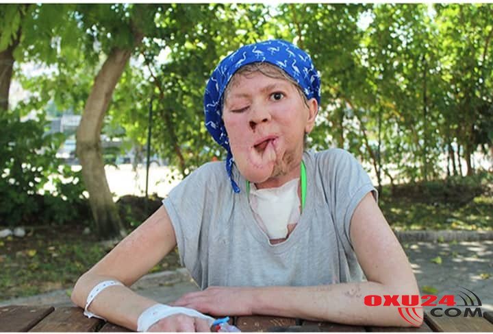 Bir sızanaq həyatını məhv etdi - Foto