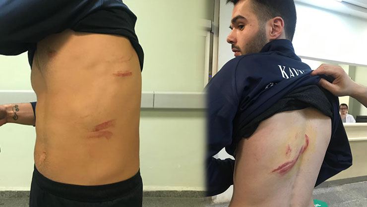 Futbolçular arasında kütləvi dava: Yaralılar var