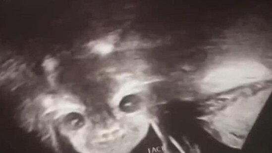 Uşağın cinsiyyətini öyrənmək üçün həkimə gedən ana həyatının şokunu yaşadı...