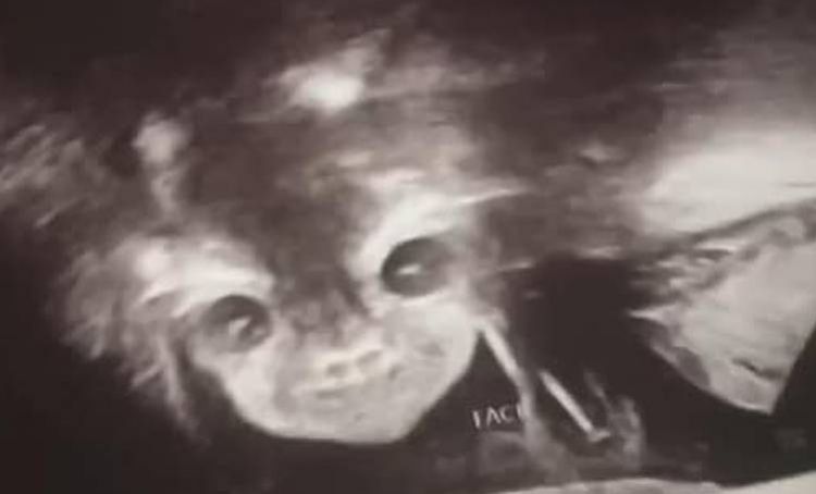 Körpəsinin cinsiyyətini öyrənmək üçün aparata girən ana ŞOKA DÜŞDÜ - Yadplanetli.../ FOTOLAR