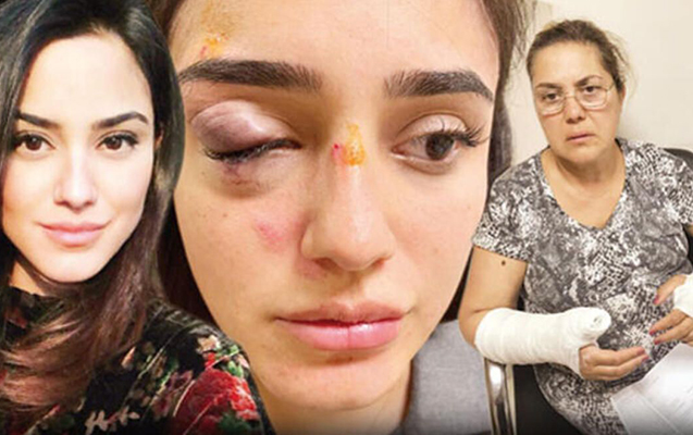 İş adamı hamilə sevgilisini küçədə döyüb bu günə qoydu - Foto