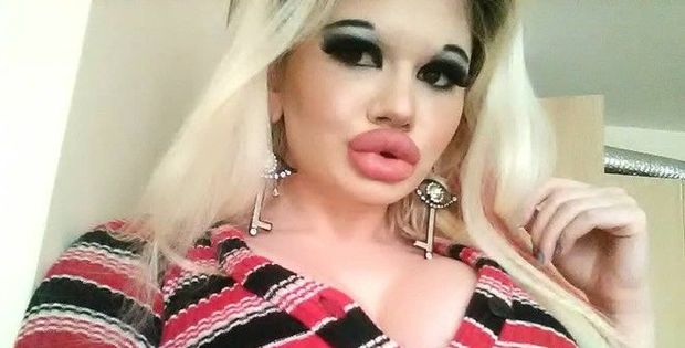 Tələbə dünyanın ən iri dodaqlı qızı olmaq istəyir - FOTO