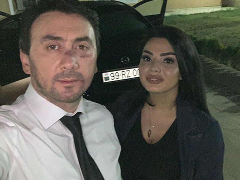 İranlılar Aqşinin 2 milyonluq klipini sildirdi - FOTO