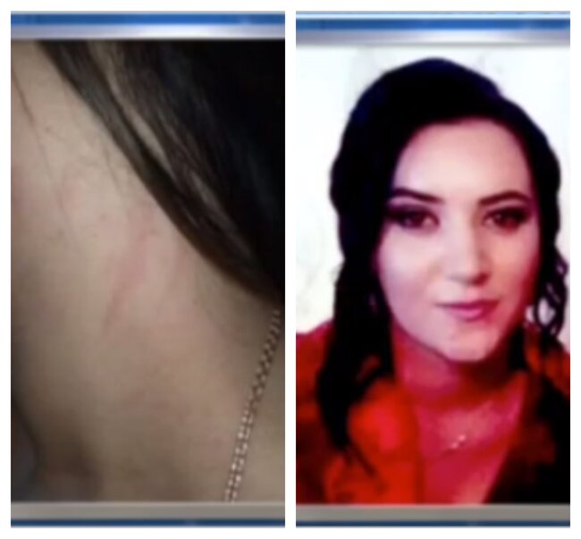 Azərbaycanda bakirə kimi başqa oğlana ərə verilən gəlinlə bağlı YENİ FAKTLAR - Evdən qaçanda hamilə imiş