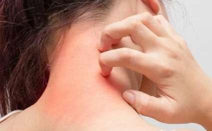 Səpkilər SİFLİS xəstəliyi ola bilər...- Həkimdən Şok AÇIQLAMA