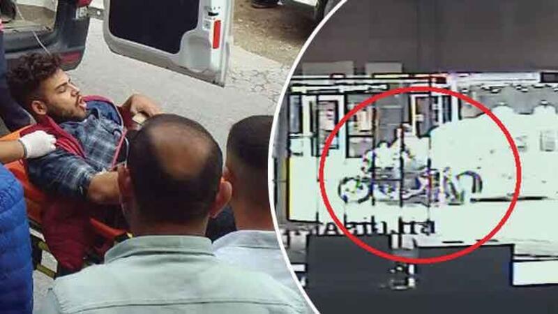 Motosiklet maşının altına girdi: Sürücünün ayağı qopdu