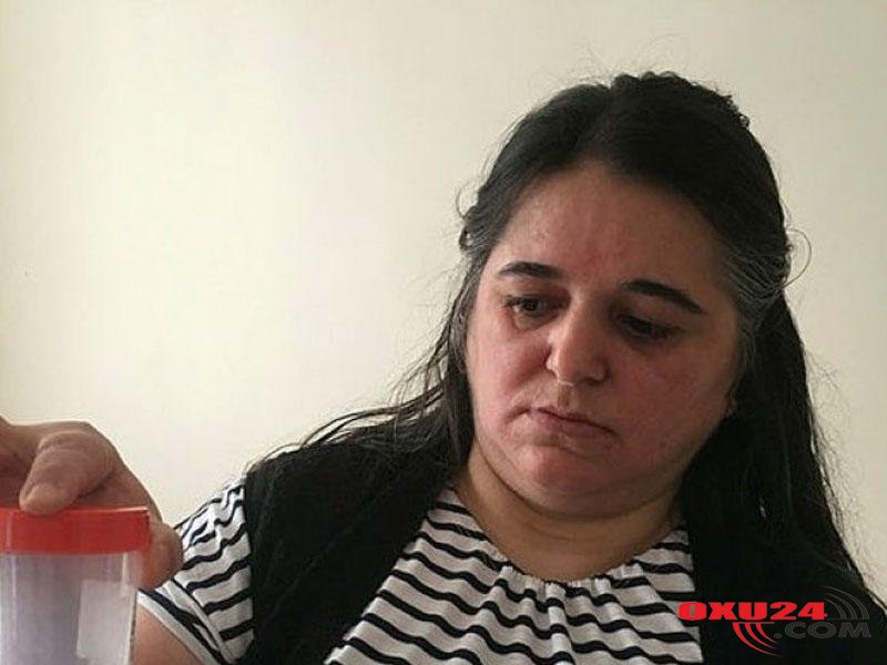 Qadının mədəsindən çıxan həkimləri şoka saldı