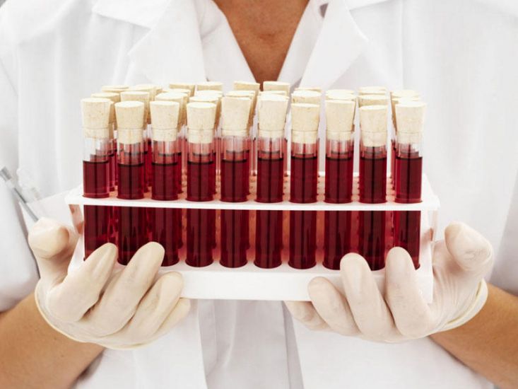 Hansı qan qrupu daha çox infarkt olur ? - ARAŞDIRMA