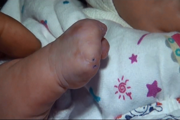 Azərbaycanda dəhşət:3 aylıq körpənin barmaqlarını kəsdilər