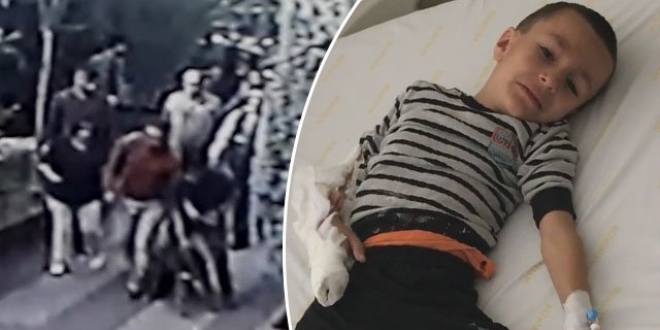 Parkda dəhşət: Pitbull uşağın qolunu parçaladı