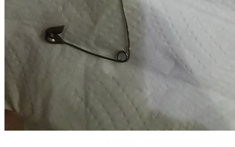 Bakıda dəhşət: qadın zavod çörəyinin içindəki sancağı uddu – “İki dövlət xəstəxanası anama kömək edə bilmədi”