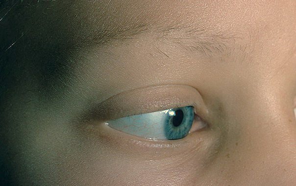 Kirpiklərimiz niyə tökülür?