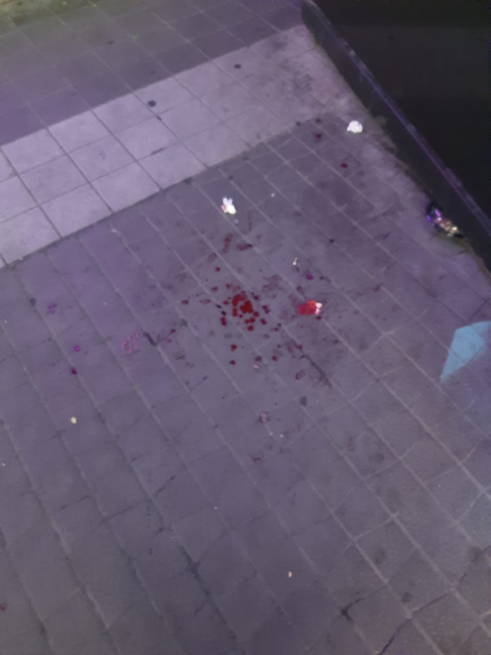 \\\"Tarqovıy\\\" da dəhşət: Gəncin üzünə lezva çəkdilər + FOTO