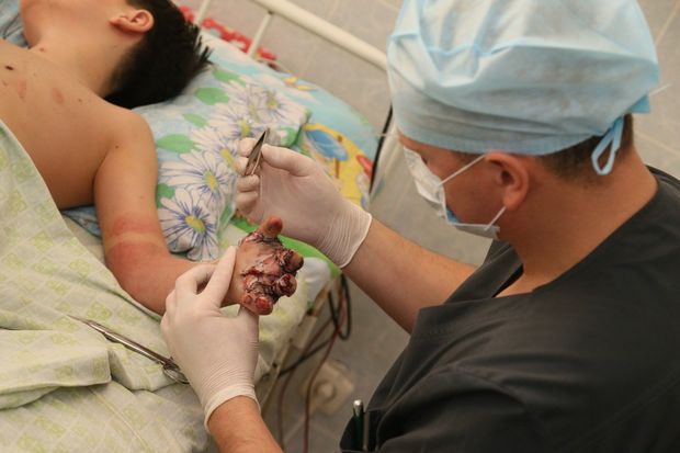 Pirotexnik vasitə uşağın barmaqlarını qopartdı