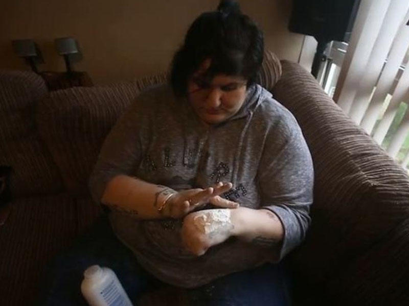 15 ildir uşaq pudrası yeyir - SƏBƏB