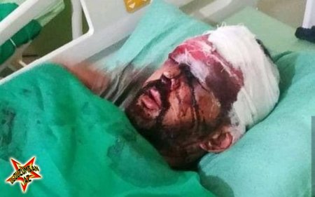 Azərbaycanlı müğənni qəzaya düşdü - QAN AXTARIRLAR