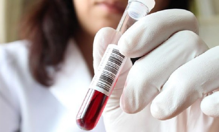 SON DƏQİQƏ! Səhiyyə Nazirliyi əhaliyə təcili müraciət edib: Qorxunc virus yayılıb