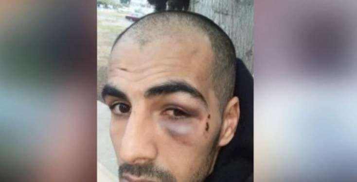 Göyçay toyunda kütləvi dava — Qıza nömrə verən ofisiant döyüldü (VİDEO)