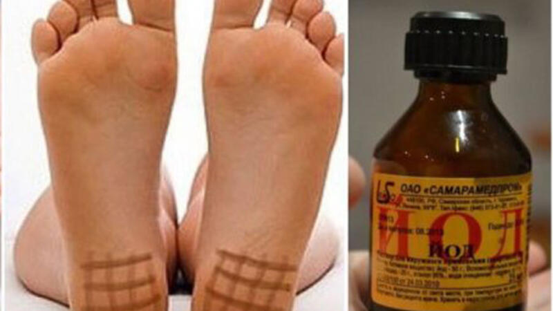 Yatmazdan əvvəl dabana yod çəkin - Səhər yuxudan qalxanda...